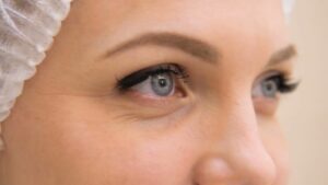 Бланширование морщин